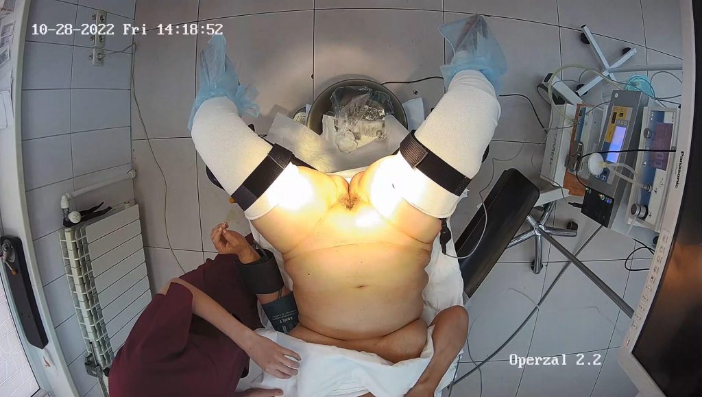 Gyno surgery hidden cam 7