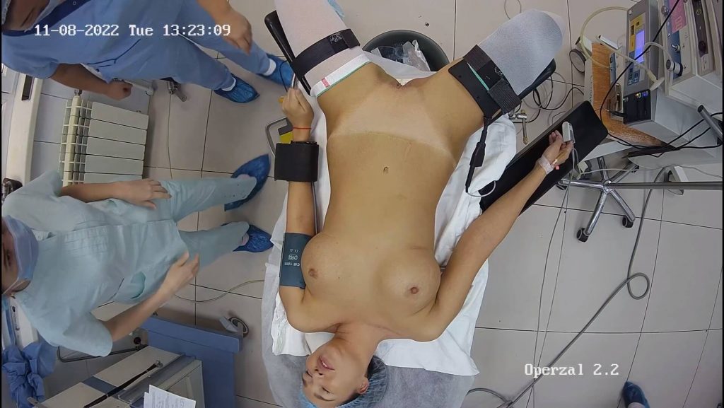 Gyno surgery hidden cam 9