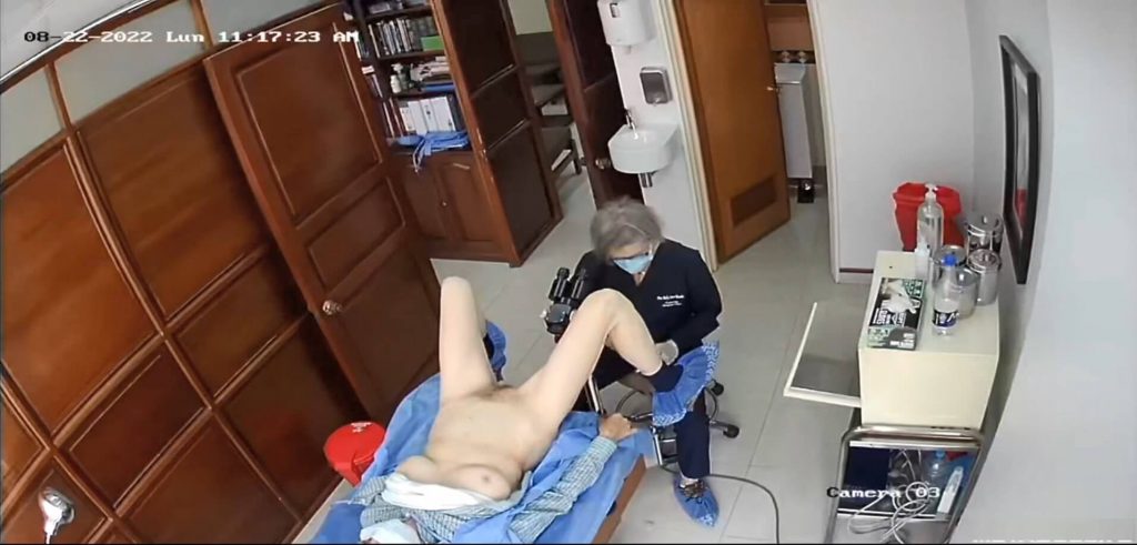 Hidden cam gynecology 197