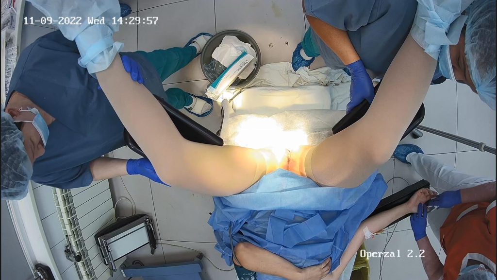 Gyno surgery hidden cam 16