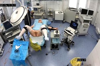 Gyno surgery hidden cam 25