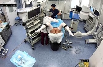 Gyno surgery hidden cam 28